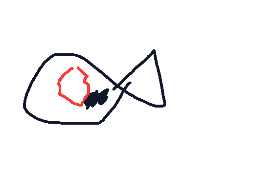 영희
